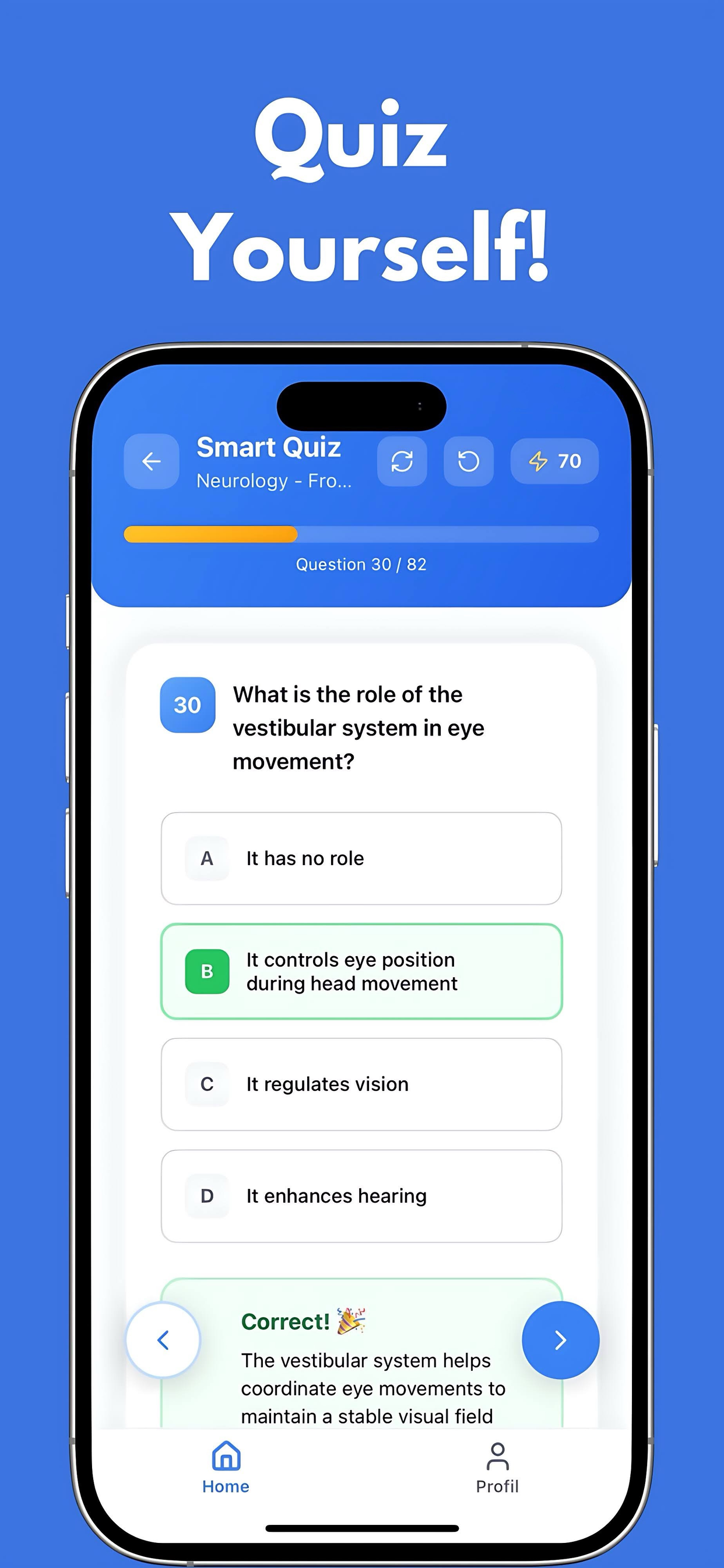 Curiosity iOS - Upload